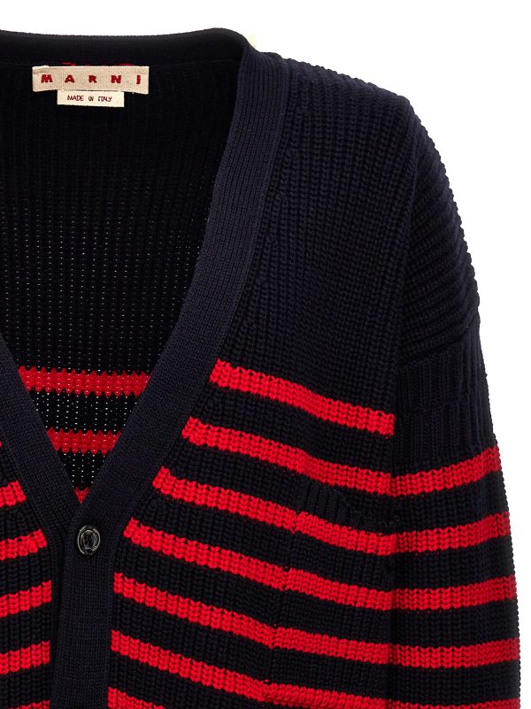 Destroyed effect striped cardigan - immagine 3